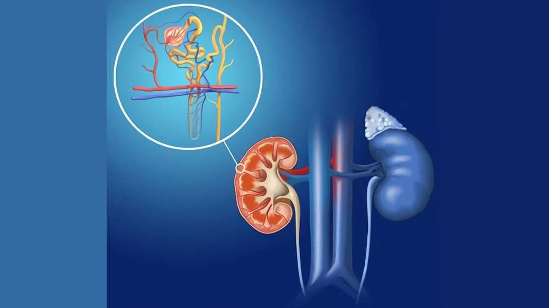 Nephron