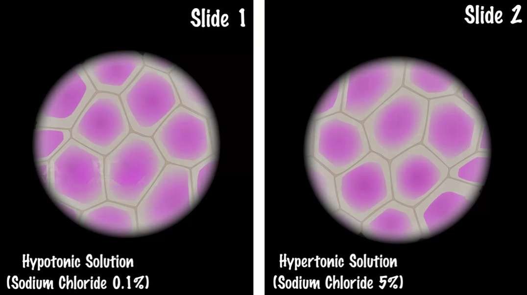 Study of Plasmolysis